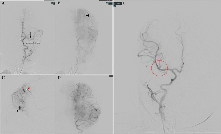 FIGURE 3