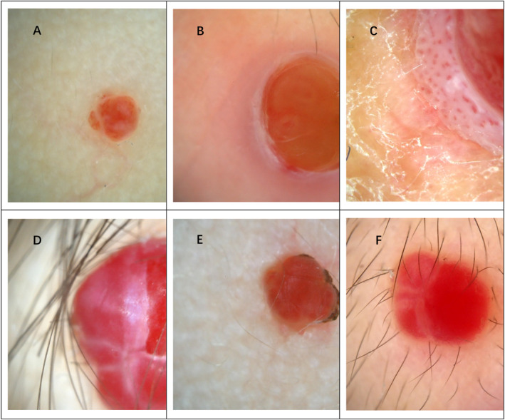 FIGURE 2