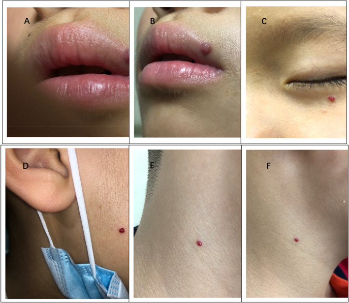 FIGURE 3