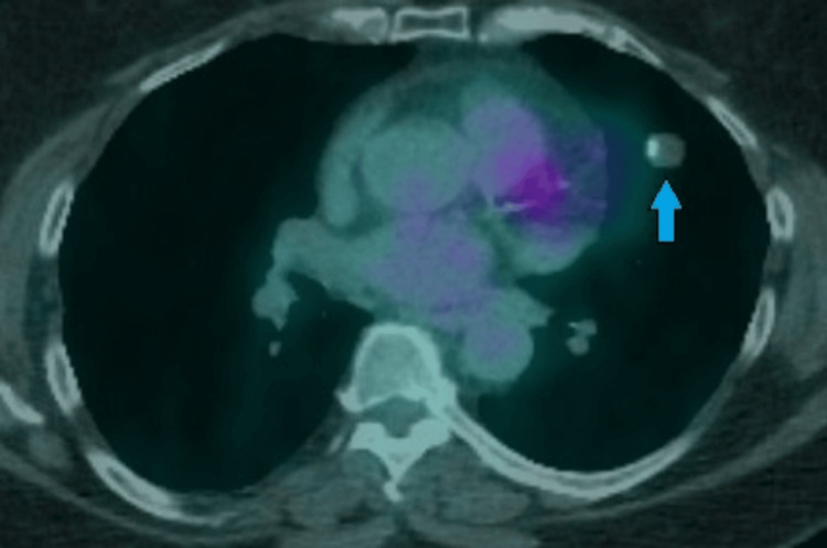 Figure 10