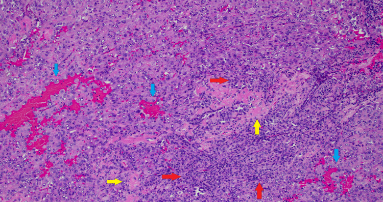 Figure 11