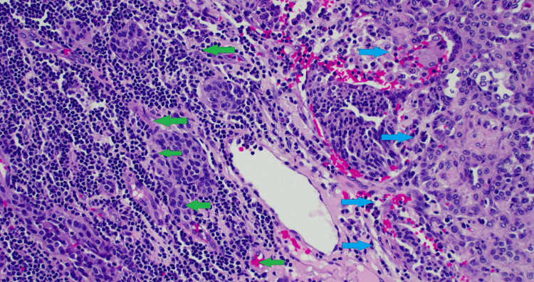 Figure 12