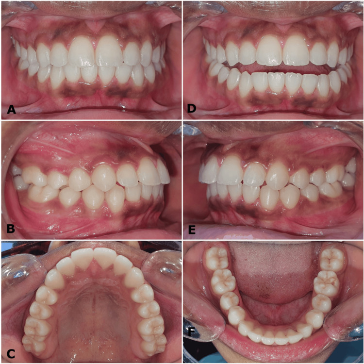 Figure 10
