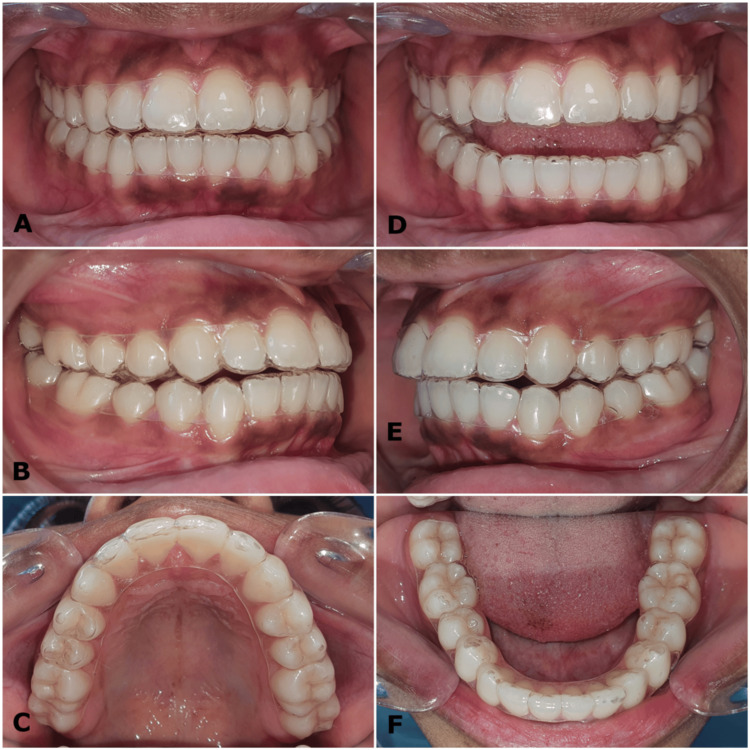 Figure 13