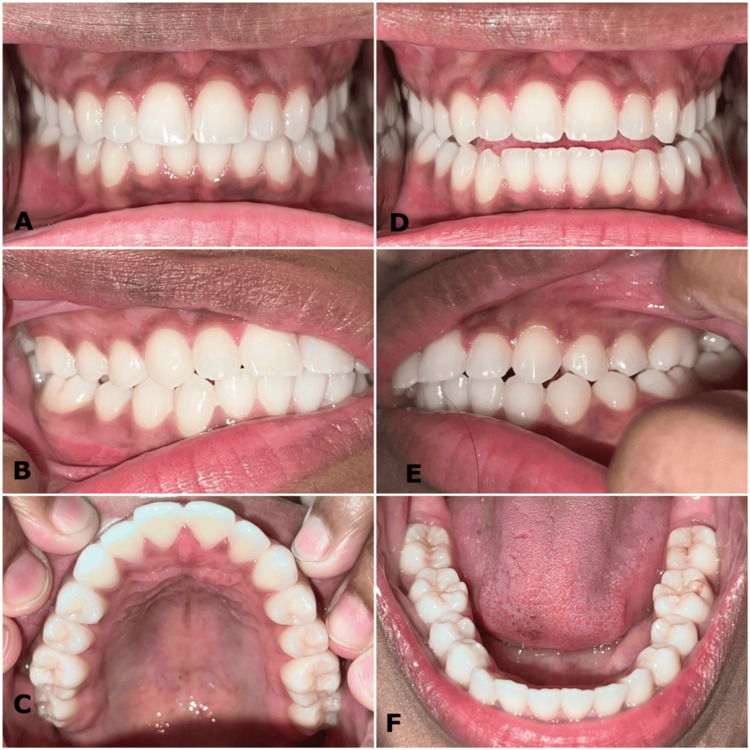Figure 15