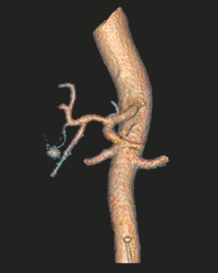 Fig. 2