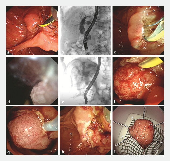 Fig. 3