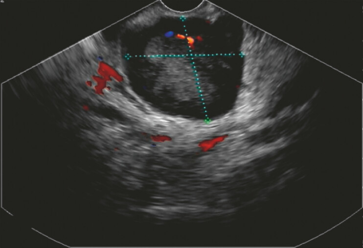 Fig. 2