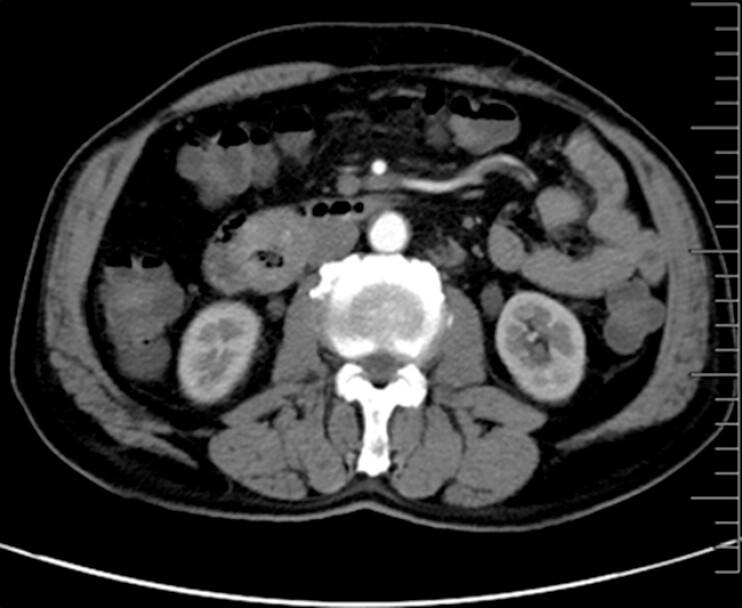 Fig. 5