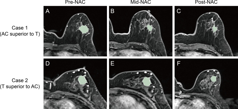 Figure 3