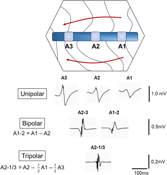 FIGURE 1