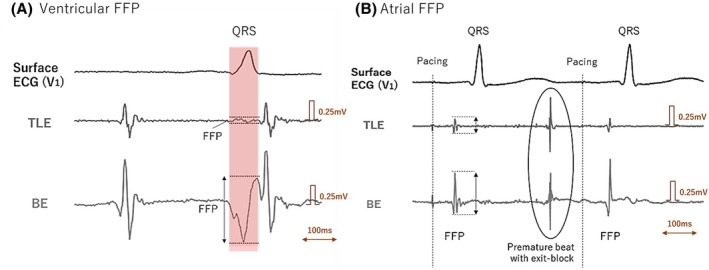 FIGURE 4