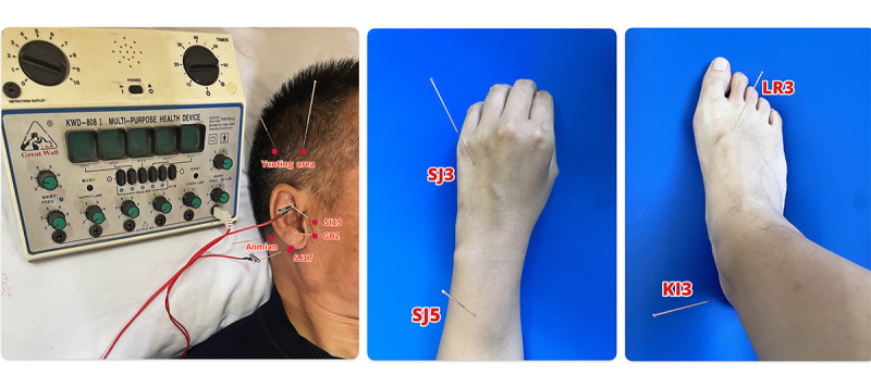 Figure 3