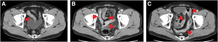 Fig. 3