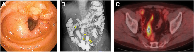 Fig. 4