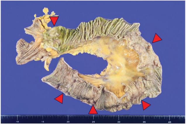 Fig. 6