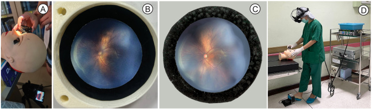 Fig 2