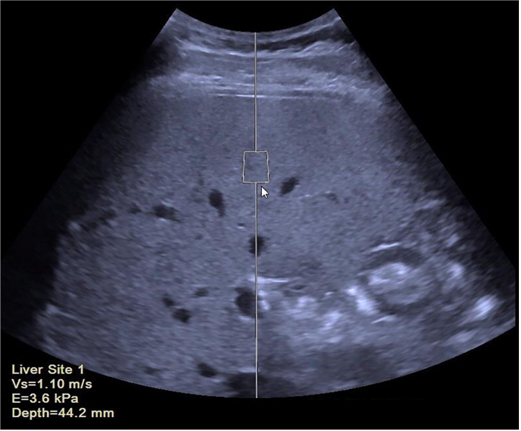 Fig 3