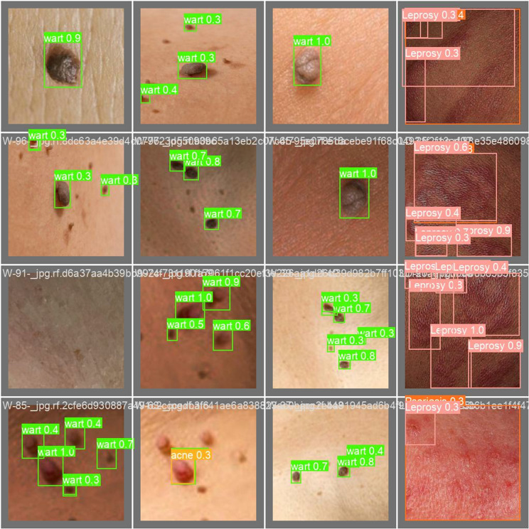 Fig 11