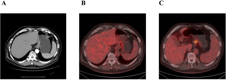 Figure 1