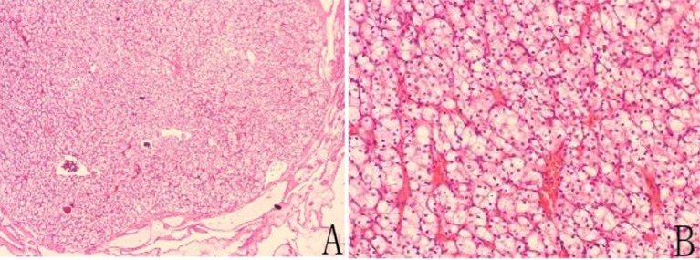 Figure 3
