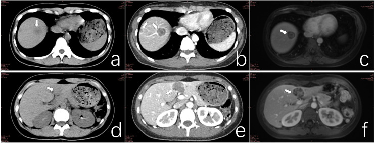 Figure 2