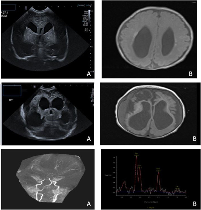 Figure 2