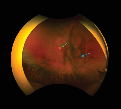 Figure 4