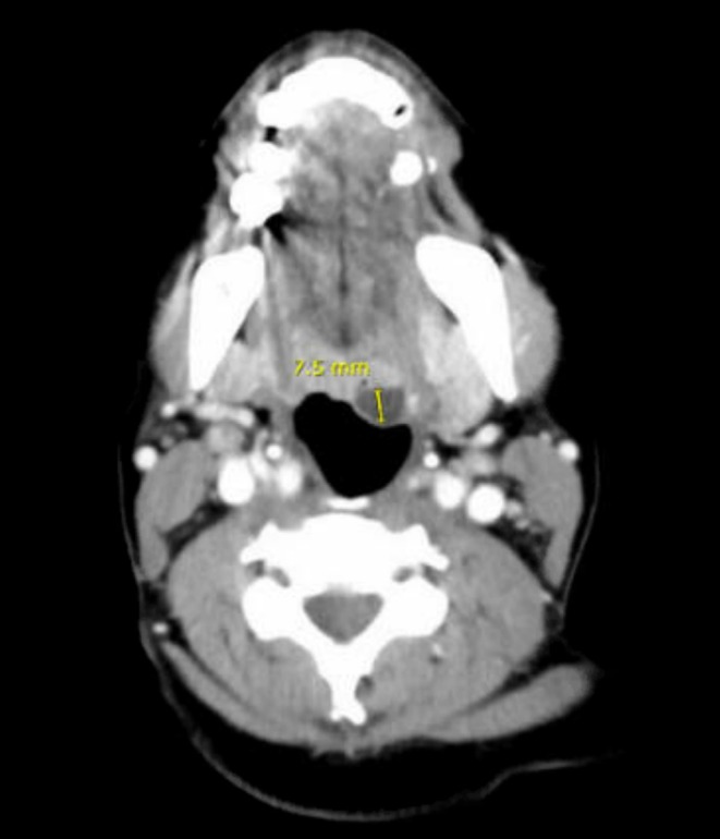 FIGURE 2