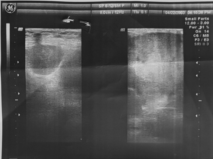 FIGURE 1