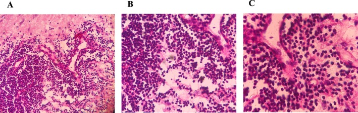 FIGURE 3