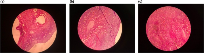 FIGURE 1