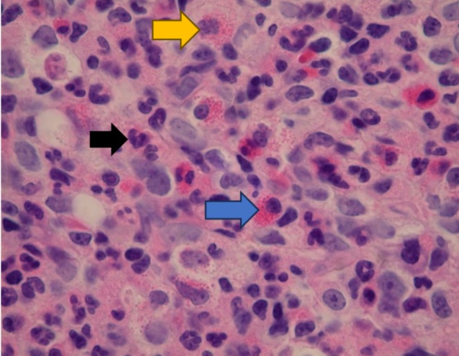 FIGURE 3