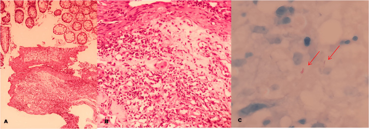 Figure 10