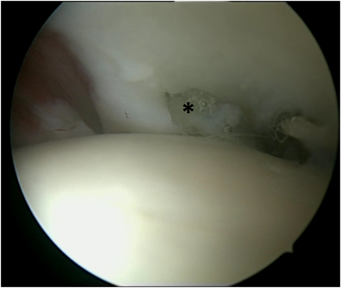 Figure 6