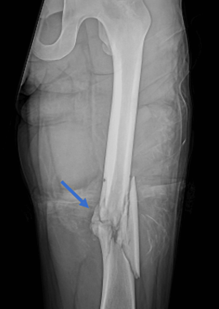 Figure 9