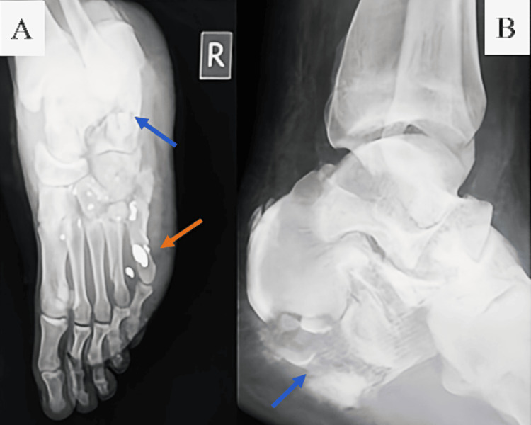 Figure 10