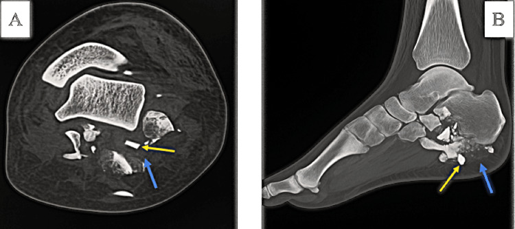 Figure 11