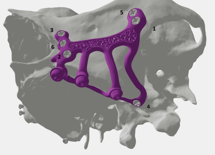 Figure 10