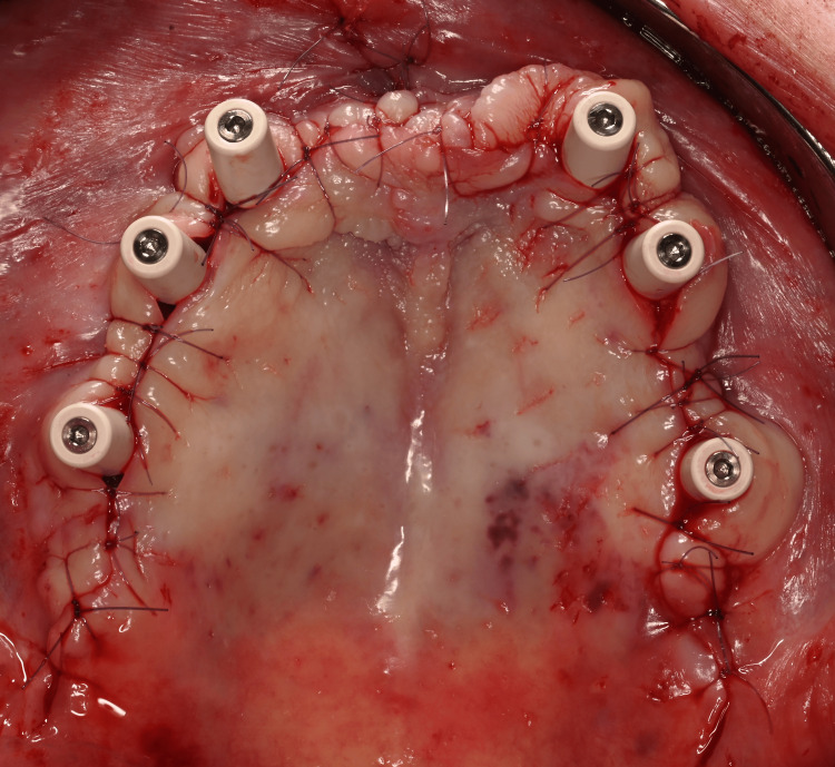 Figure 13