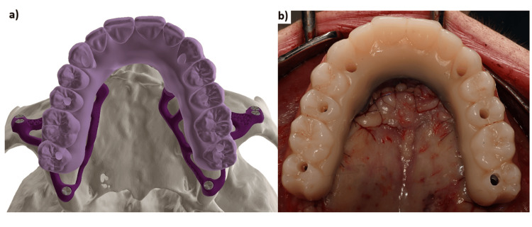 Figure 14