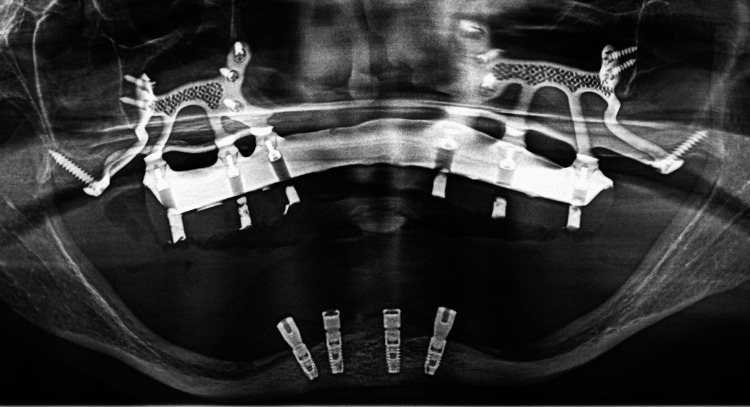 Figure 15