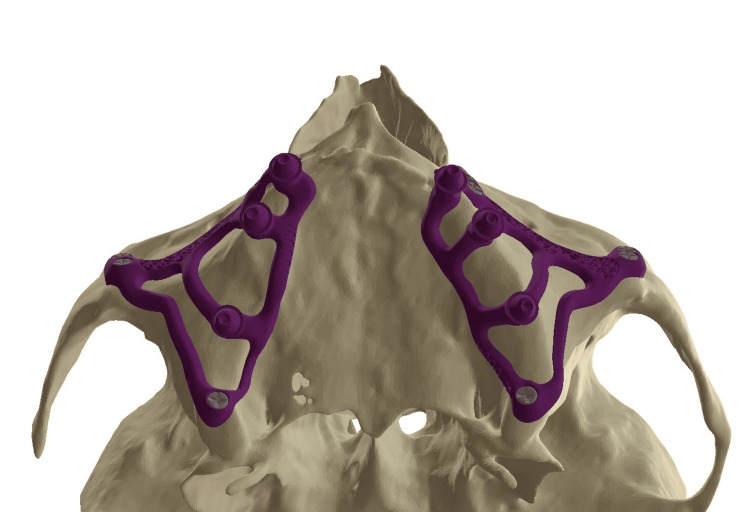 Figure 16