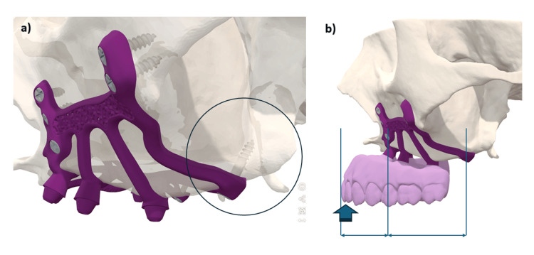 Figure 17