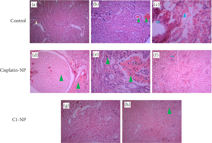 Figure 11