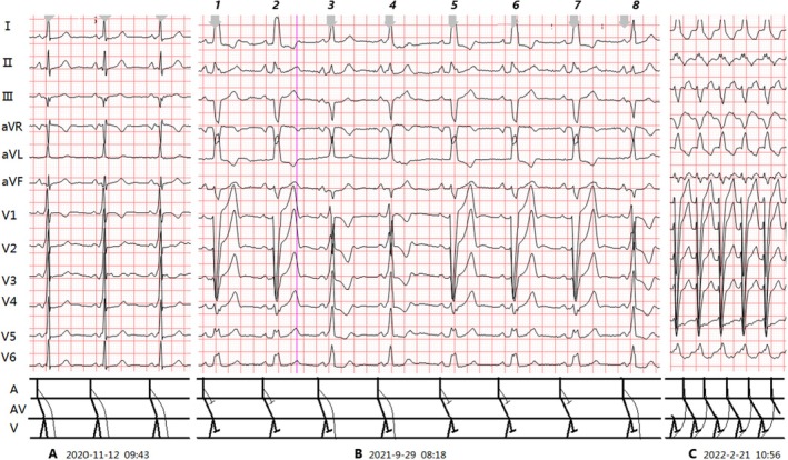 FIGURE 2