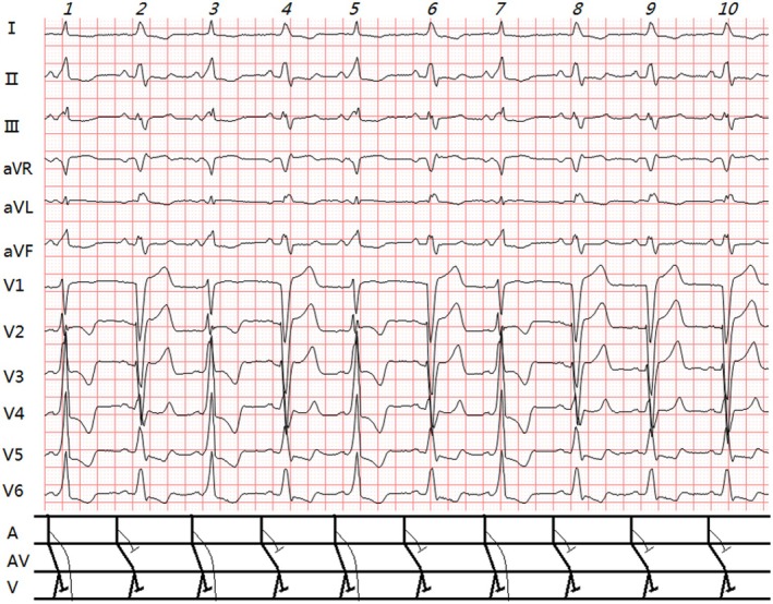 FIGURE 3