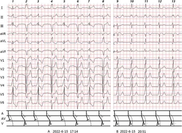 FIGURE 4