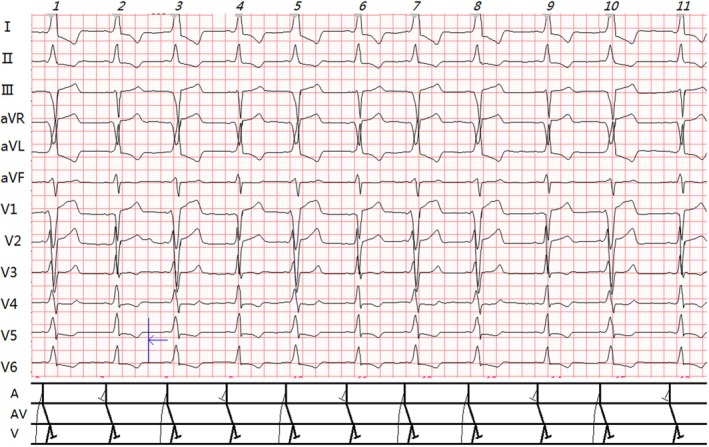FIGURE 1