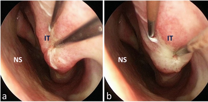 FIGURE 1